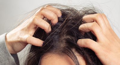 Reasons and Remedies for Dry and Itchy Scalp
